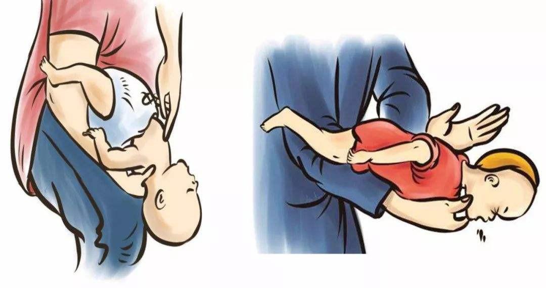 家庭急救指南，骨折伤情处理步骤