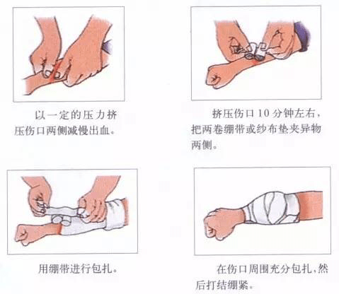 家庭急救指南，切割伤的止血与急救技巧