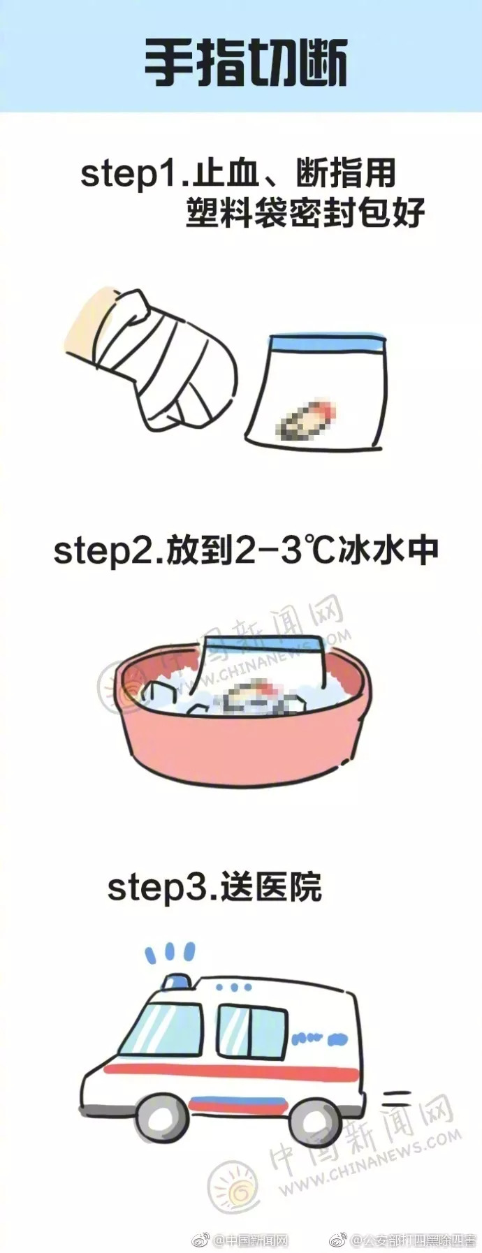 家庭急救中的常见误区解析与避免策略