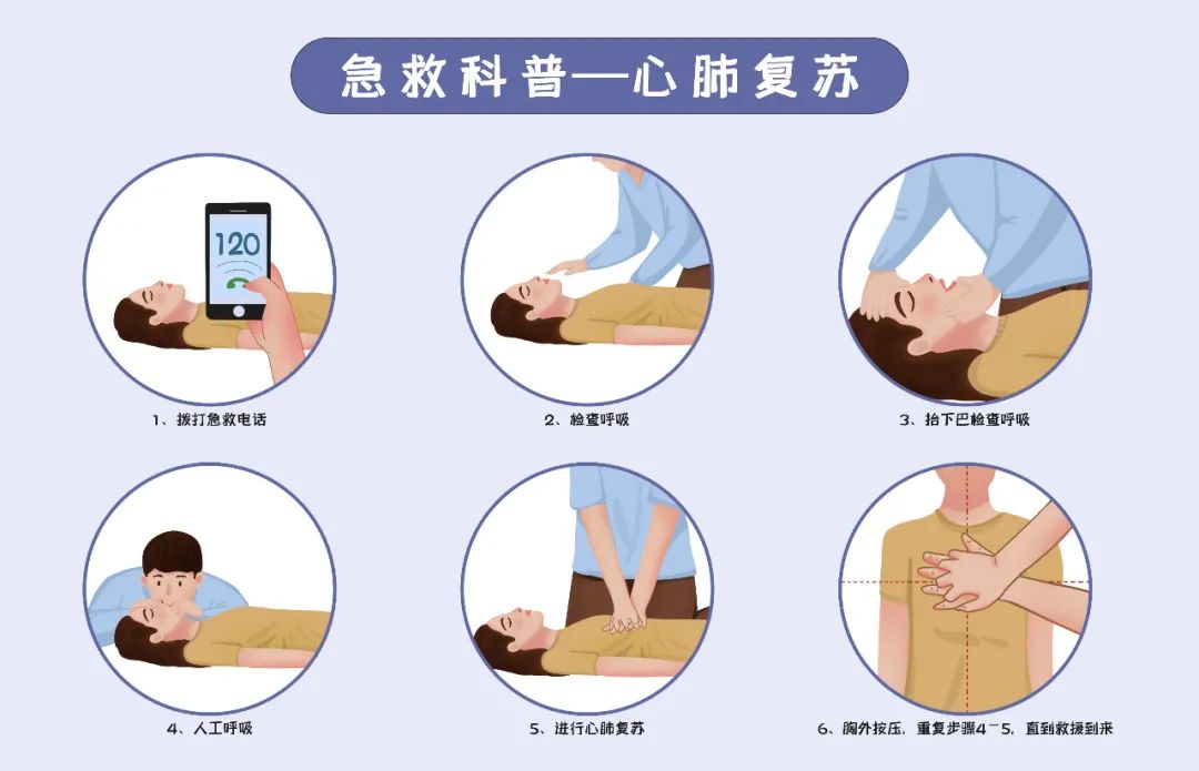 心跳骤停的家庭急救步骤与指南