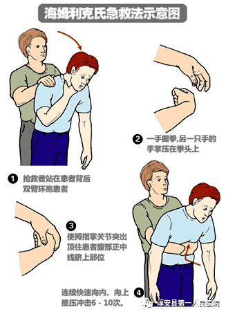 孩子窒息急救步骤与方法指南